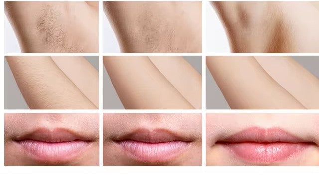 IPL Laser Hair Remover – Premium Touch & Compact Edition